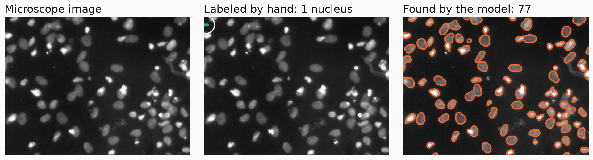 Three panels of the same fluorescence microscope image with about 80 nuclei. Left: the image. Middle: the only hand-drawn label, a small sliver at the left edge, circled in white. Right: 77 nuclei outlined in orange by the model.