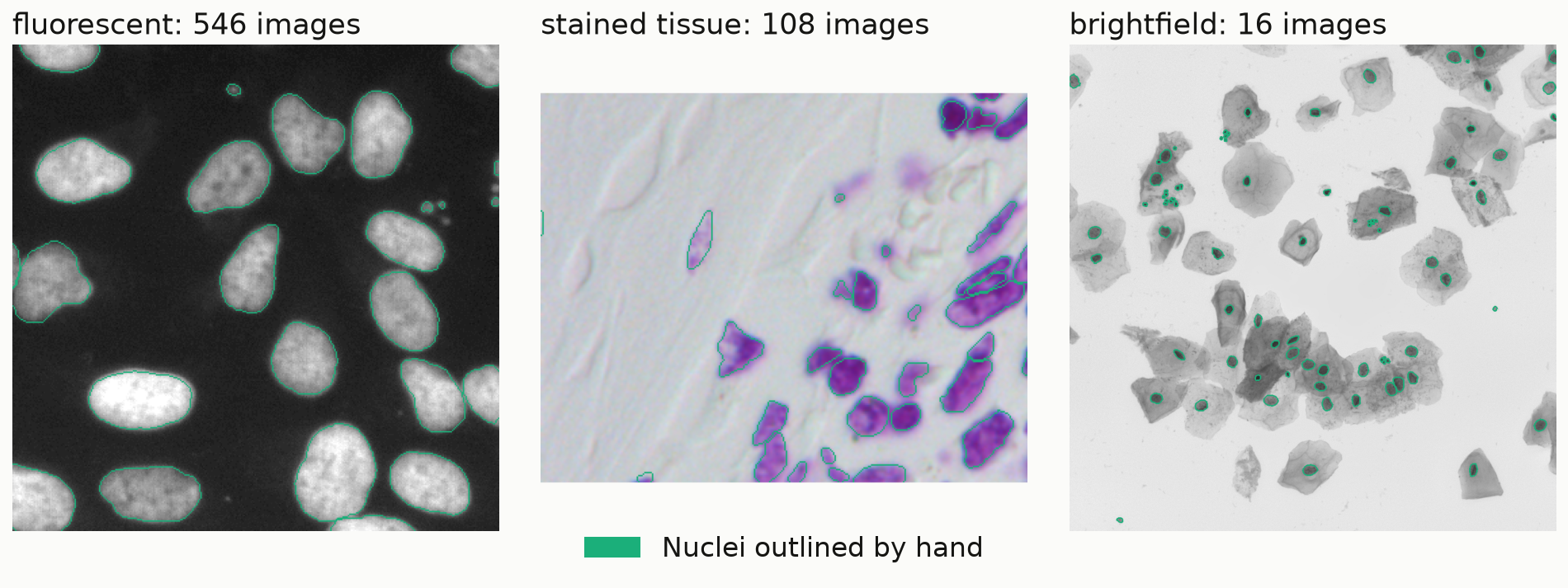 Three microscope images with nuclei outlined in green: a fluorescent image with bright oval nuclei on black, a stained tissue section with purple nuclei, and a brightfield image of gray cells with small dark nuclei