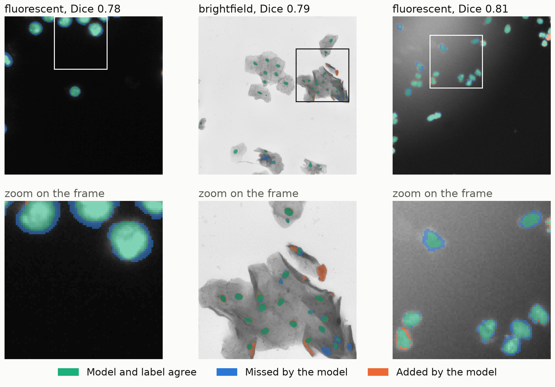 Three test images with nuclei colored green where model and label agree, blue where the model missed label pixels and orange where the model added pixels, each with a zoomed crop below. The fluorescent zooms show green nuclei with thin blue rings; the brightfield zoom shows a few blue nuclei and orange streaks on dark folds of a cell