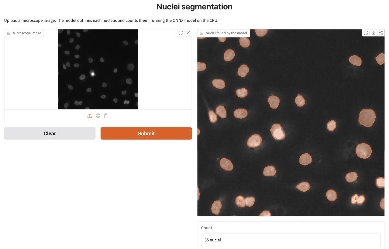 Screenshot of the Gradio web app: a fluorescence microscope image on the left, the same image with each nucleus outlined in orange on the right, and a count box reading 35 nuclei